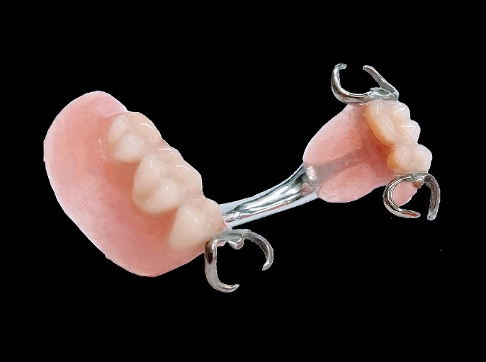 歯を失ったときの治療「入れ歯」