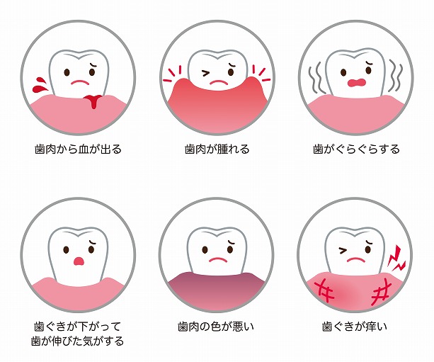 手遅れになる前に！症状チェック